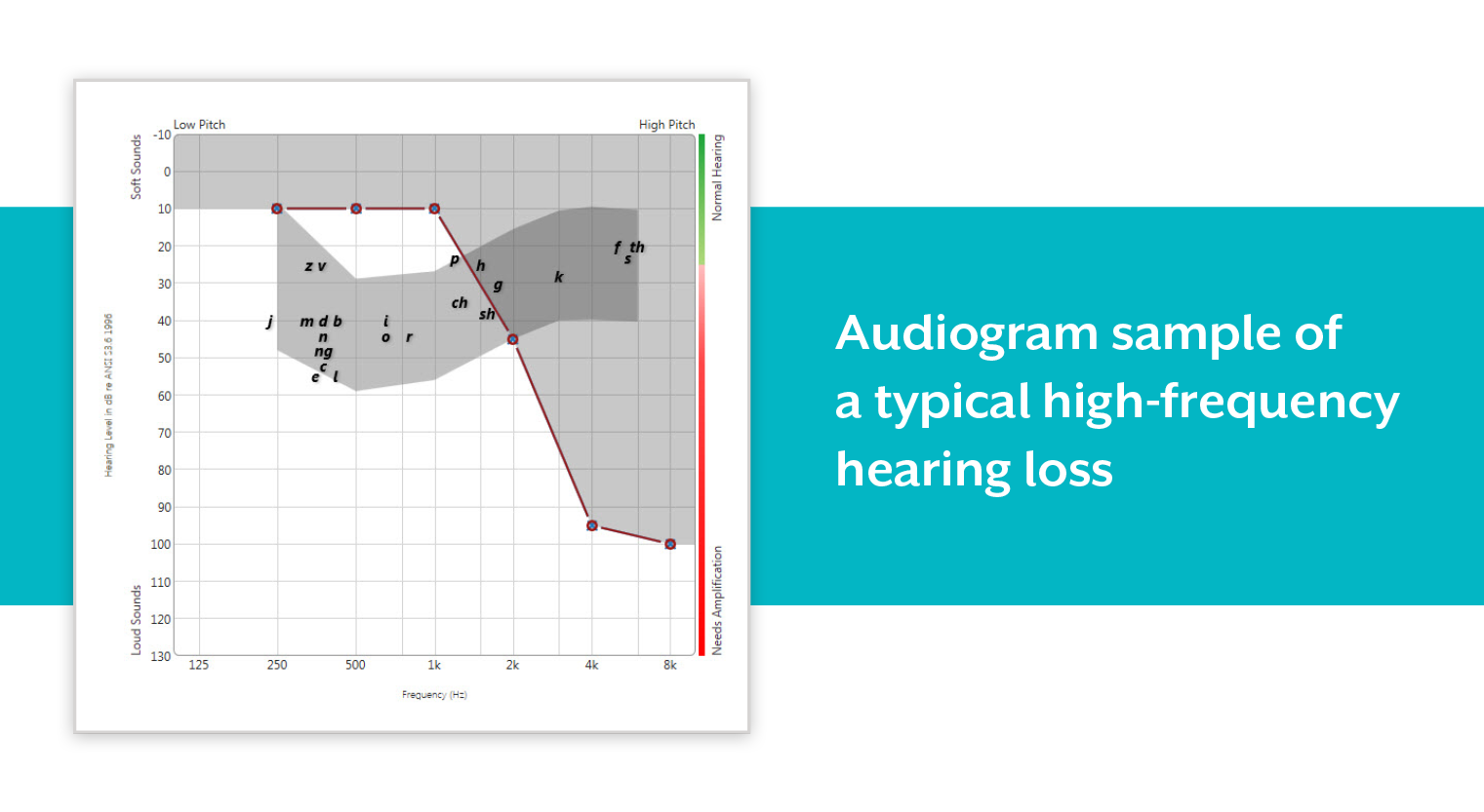 Normal Hearing Test Chart