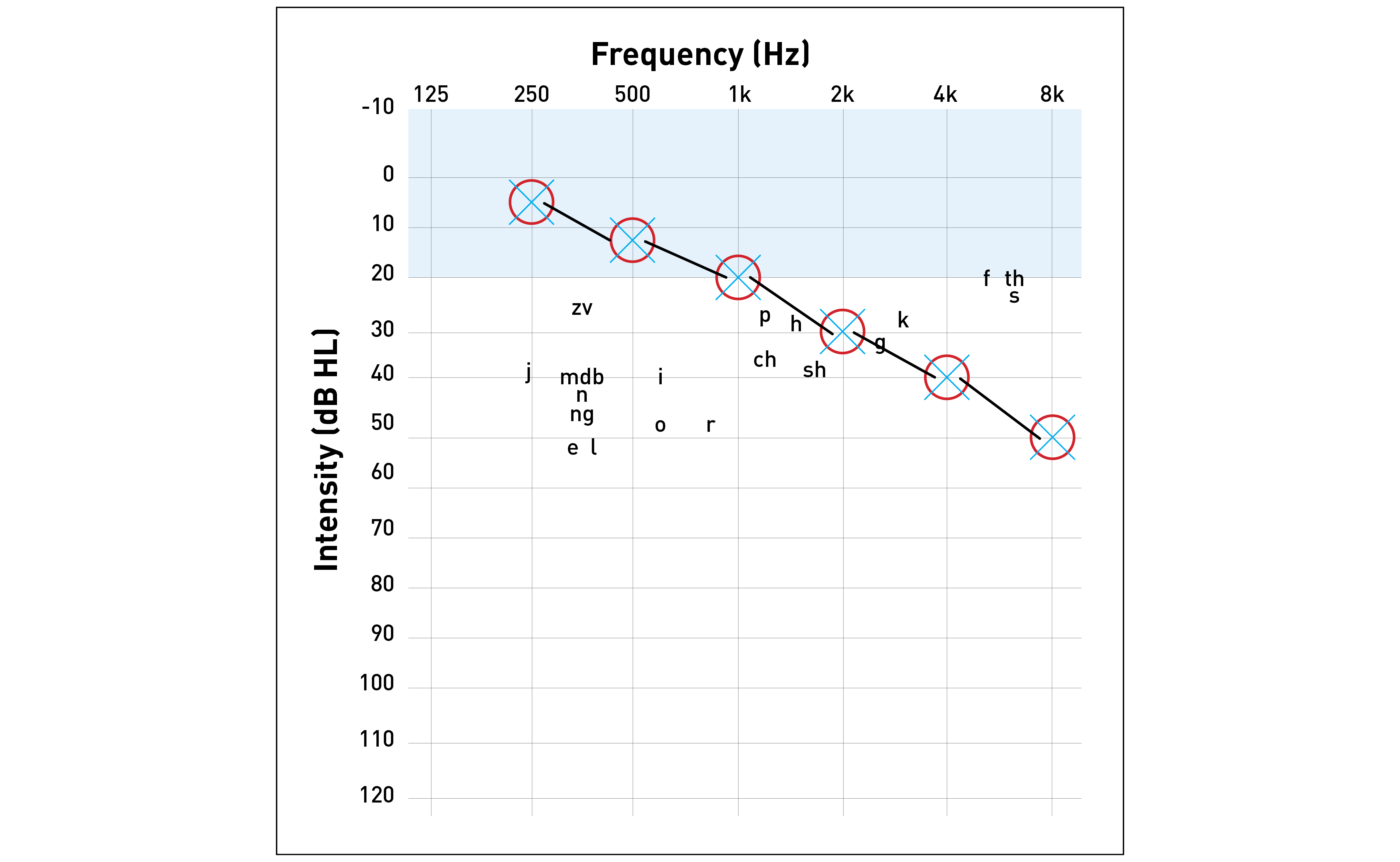 Image of an audiogram