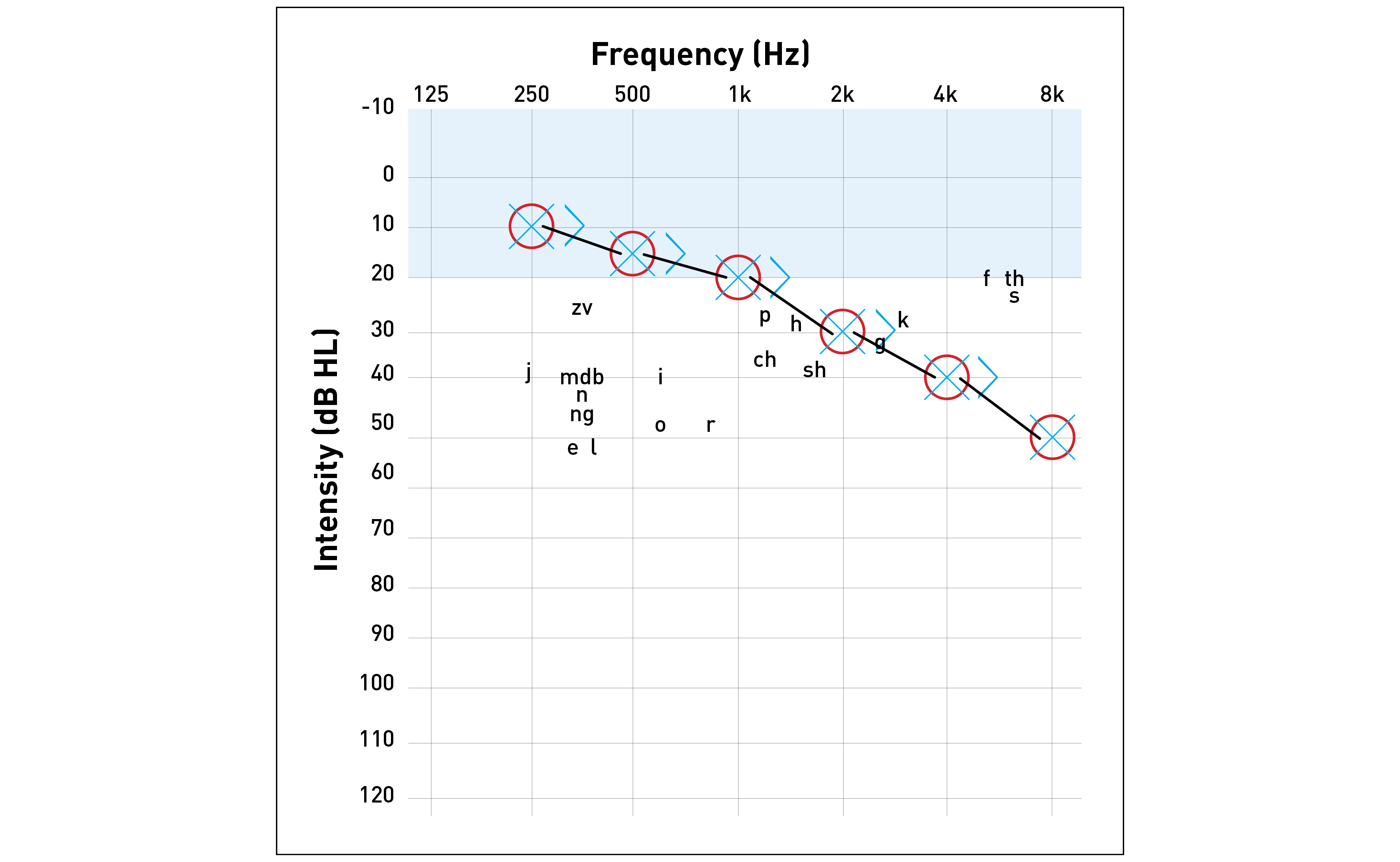 Image of an audiogram