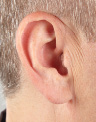 CIC Hearing Aid
